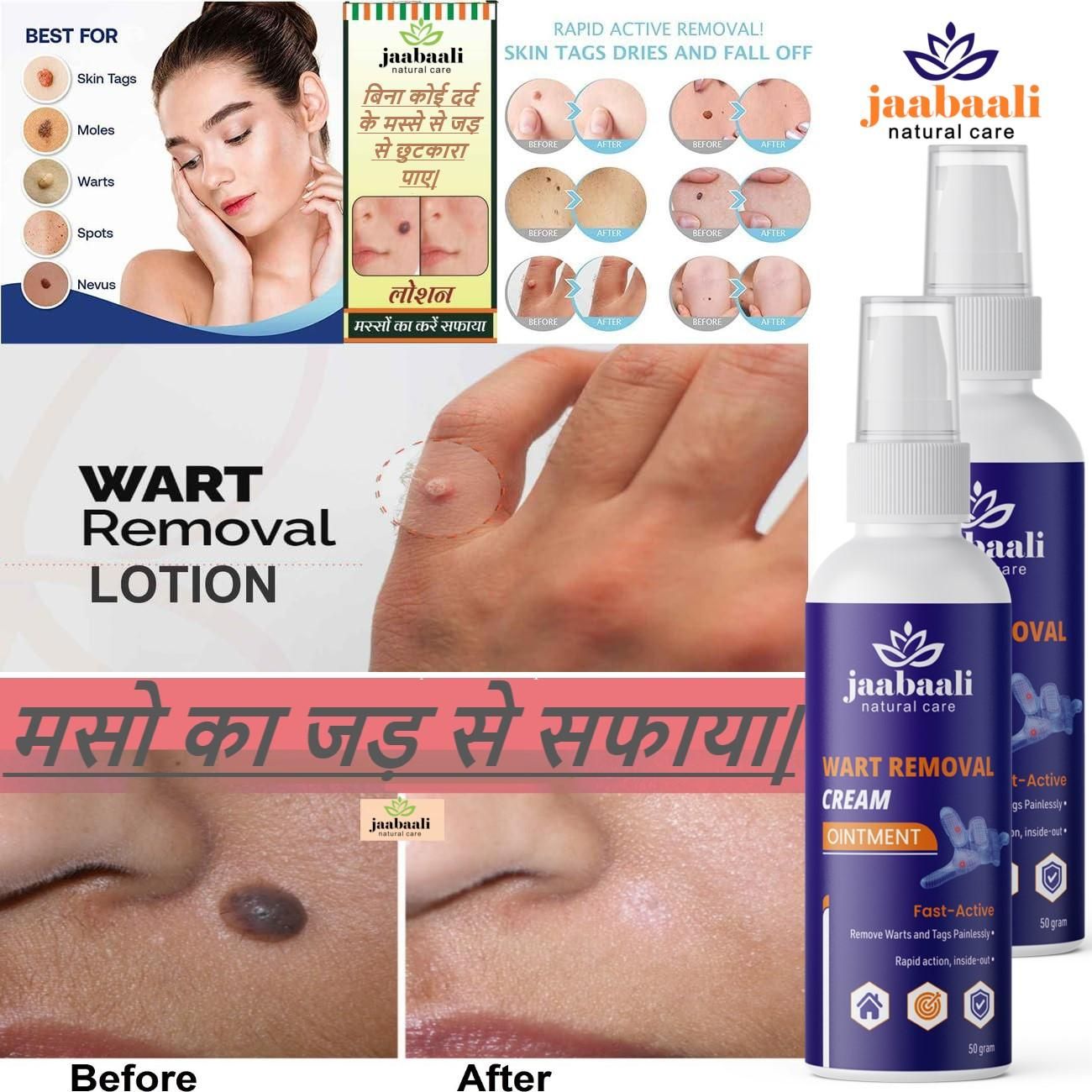 Wart Remover Cream (Pack of 2)